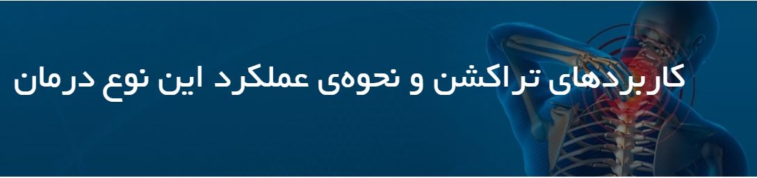 تراکشن